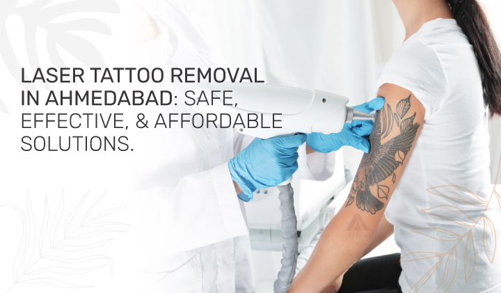 laser tattoo removal in ahmedabad